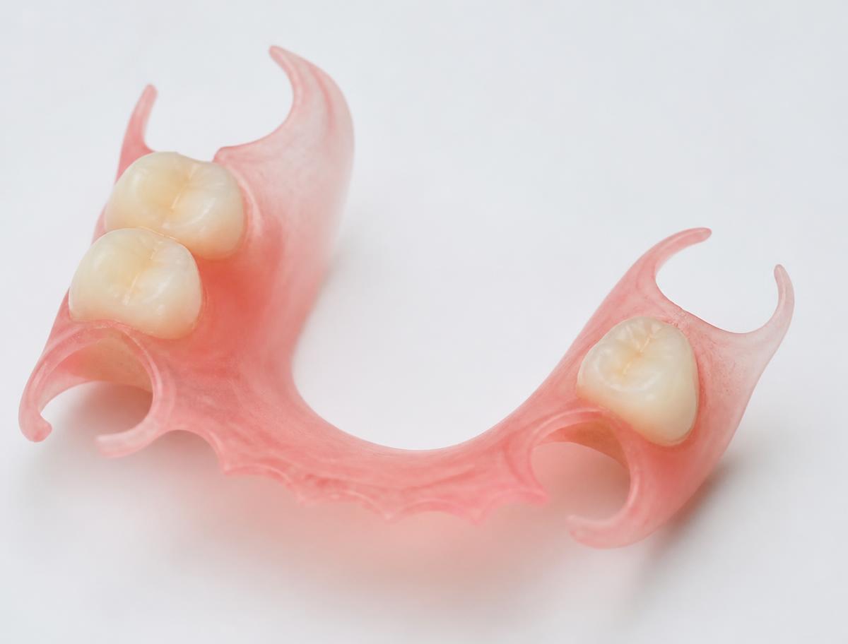 Flexible Denture — 1 to 3 Teeth